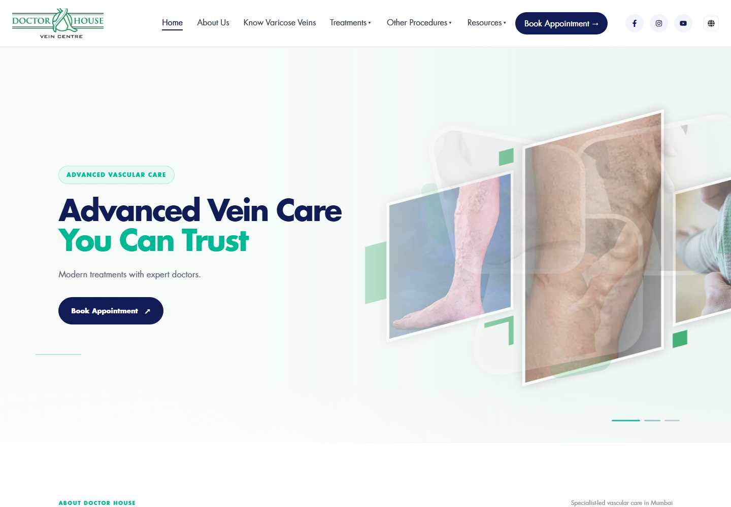 Varicose Veins India website homepage